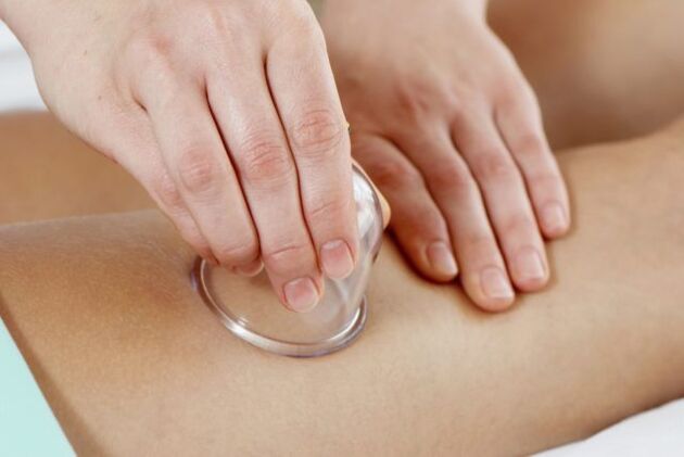 massage cupping do veins varicose